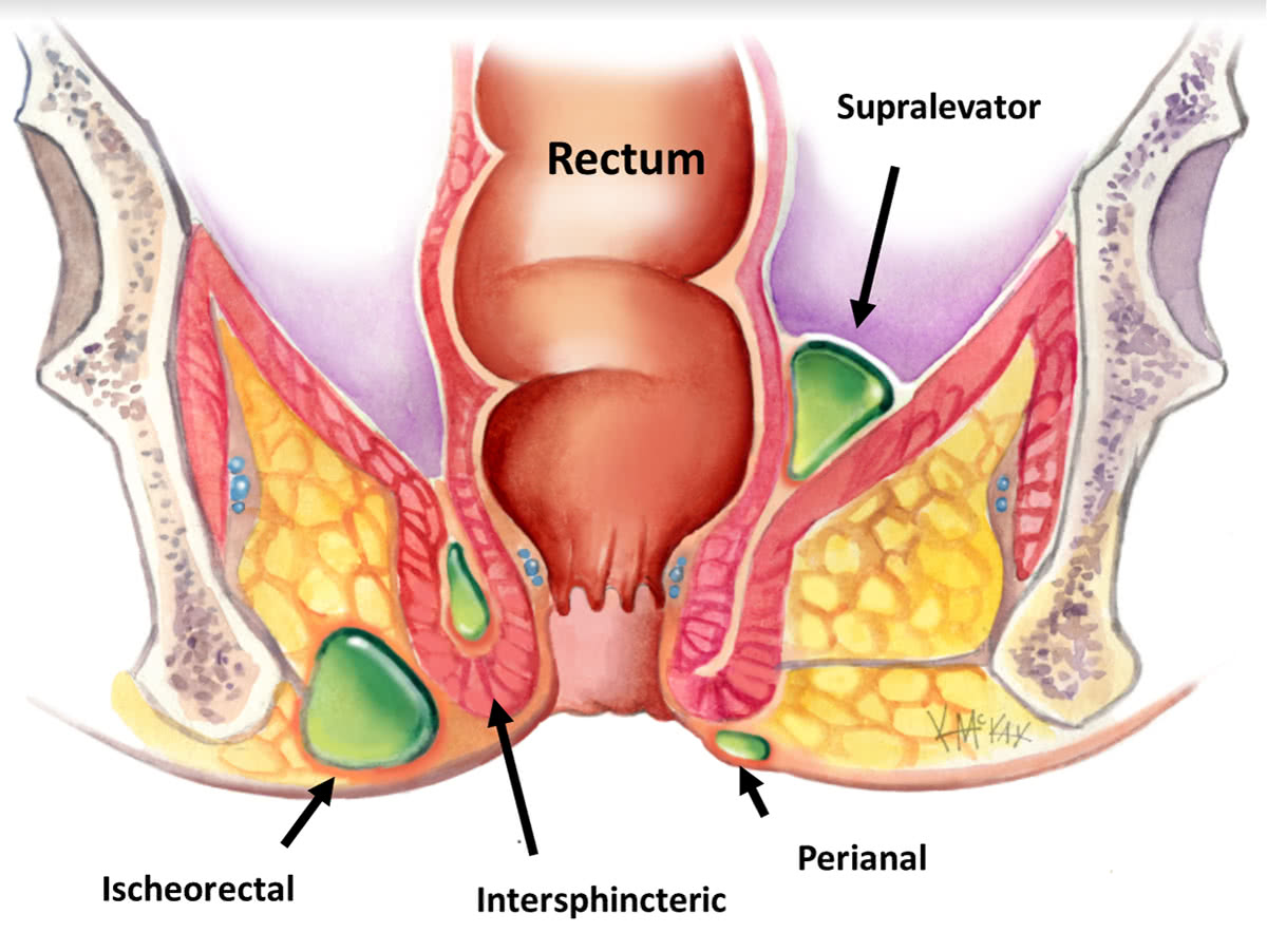 Anal Region 104