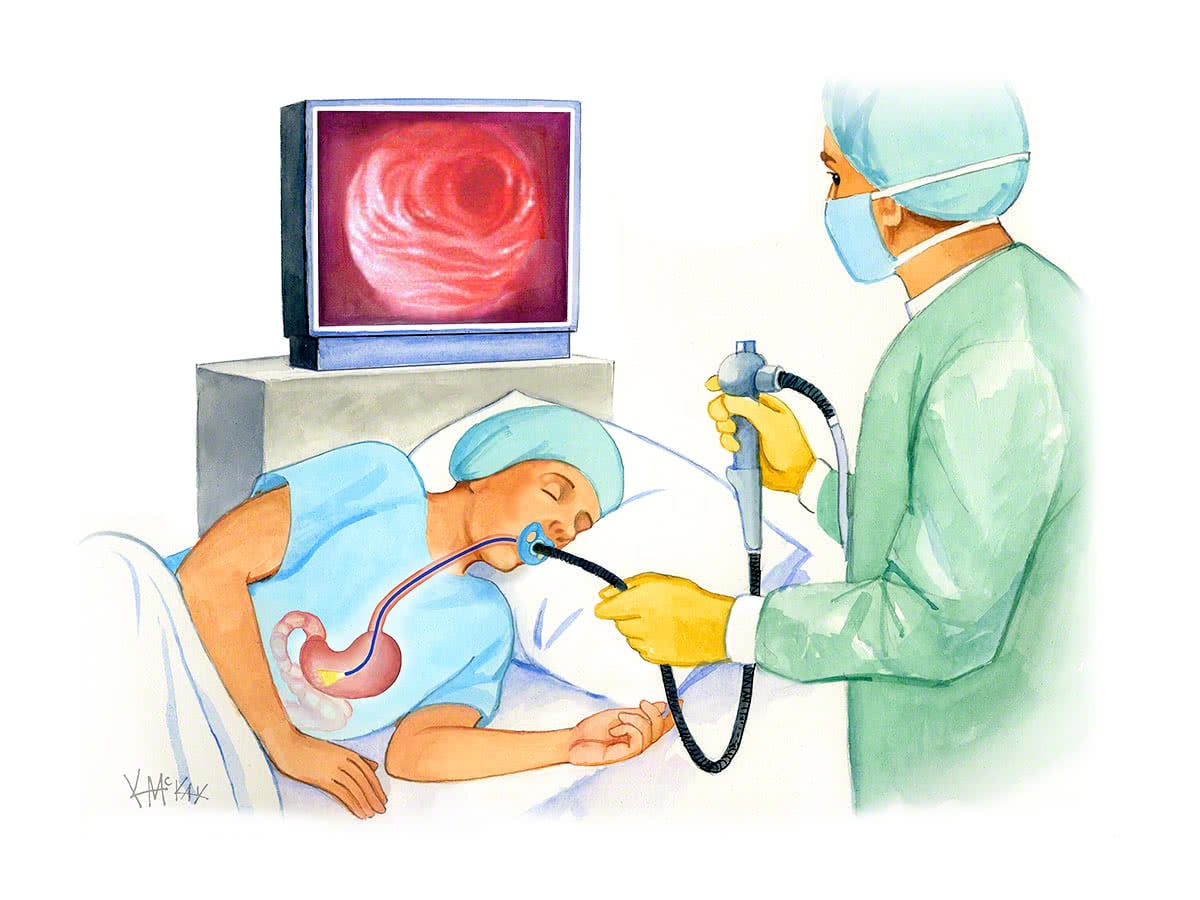 Gastroscopy Colorectal Surgeons Sydney